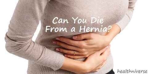 can you die from a hernia? check the answer by this facts