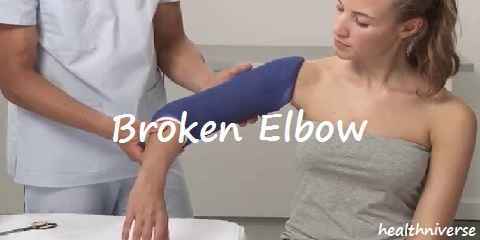 broken elbow