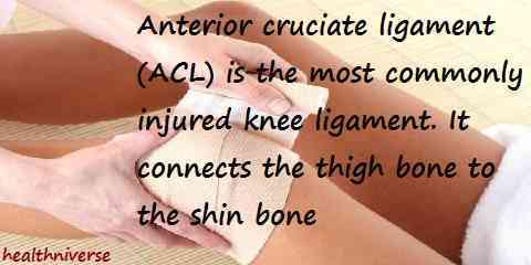 can you walk with a torn acl lcl mcl knee injury