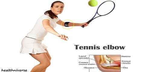 tennis elbow splint support wrap
