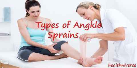 types of ankle sprains