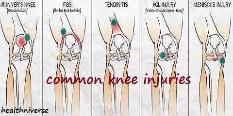 pain on inner side of knee