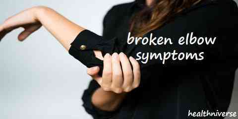 broken elbow symptoms