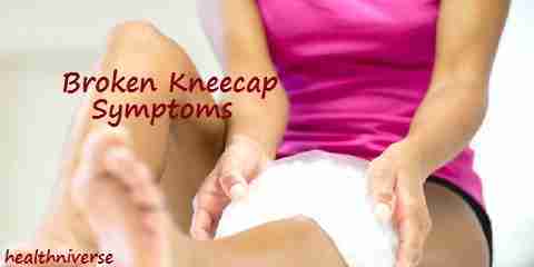broken kneecap symptoms