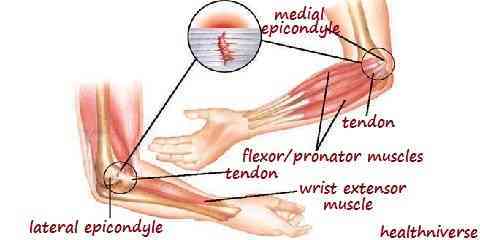 signs of a fractured elbow or indications of broken elbow