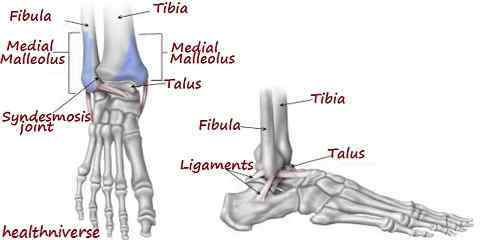 signs of a broken ankle symptoms vs sprain