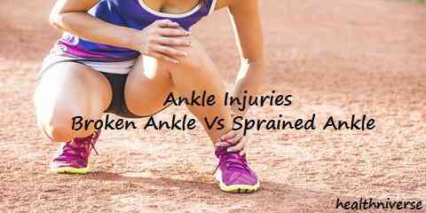 broken ankle vs sprained ankle
