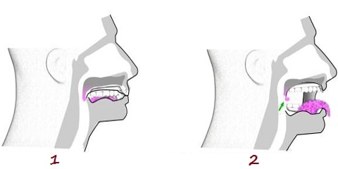 throat exercises for sleep apnea