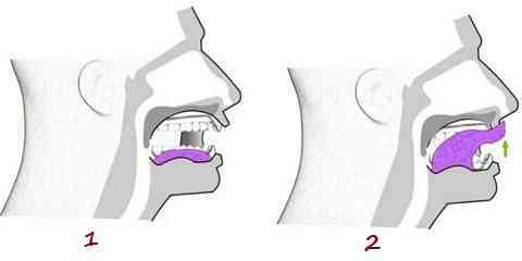 tongue exercises for sleep apnea