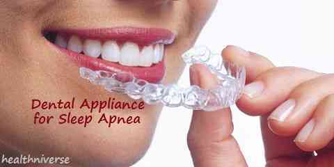 dental appliance for sleep apnea